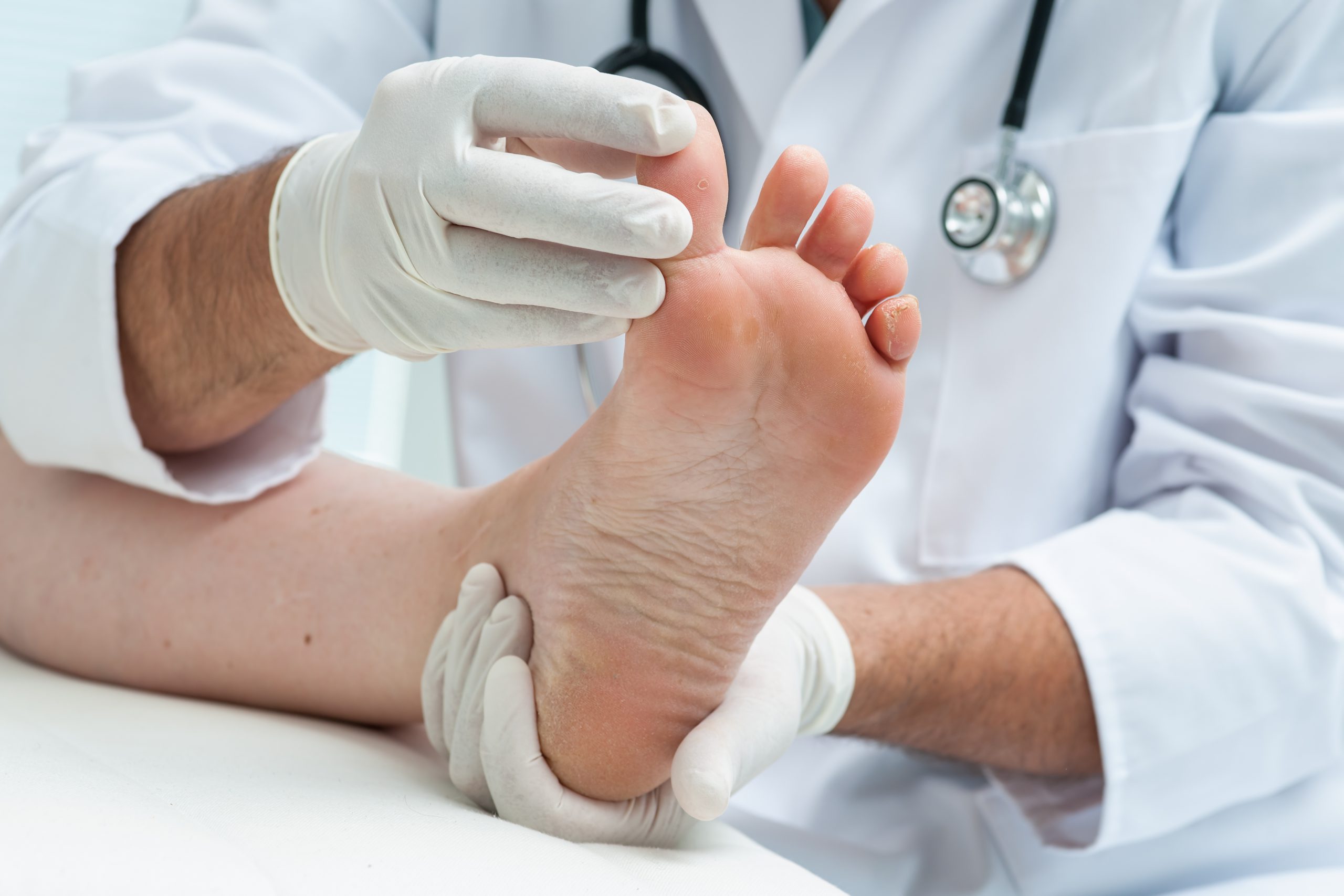Hammer Toe Surgery: Fix Foot Pain